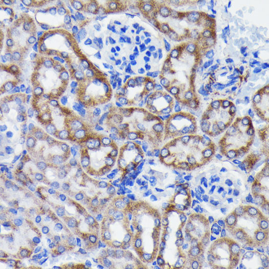 Prohibitin Antibody in Immunohistochemistry (Paraffin) (IHC (P))