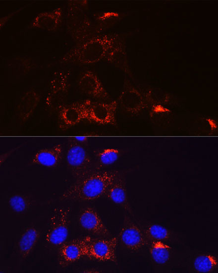 PDGFRB Antibody in Immunocytochemistry (ICC/IF)