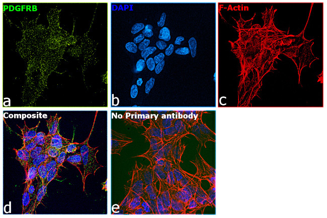 PDGFRB Antibody in Immunocytochemistry (ICC/IF)