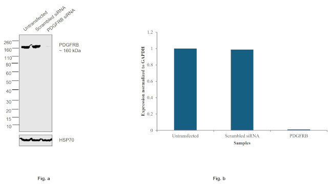 PDGFRB Antibody in Western Blot (WB)