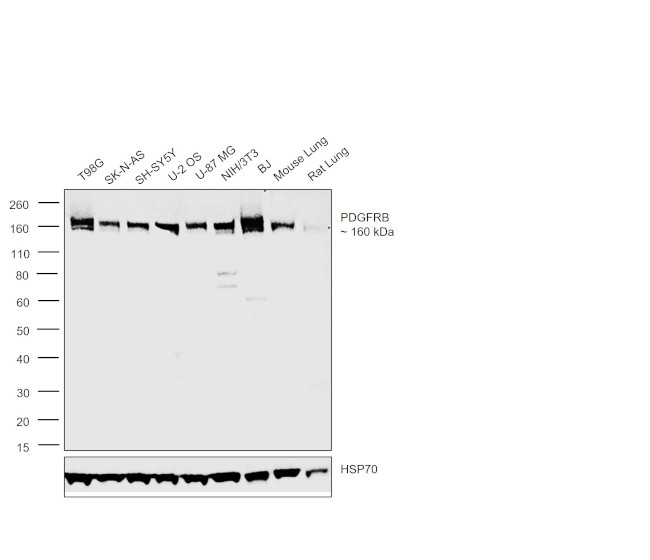 PDGFRB Antibody in Western Blot (WB)