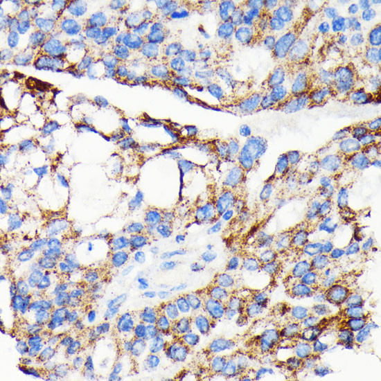 AIF Antibody in Immunohistochemistry (Paraffin) (IHC (P))