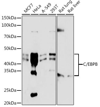 C/EBP beta Antibody in Western Blot (WB)