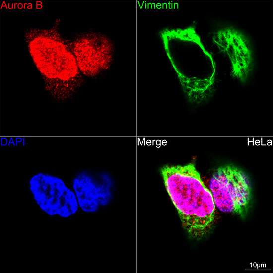 Aurora B Antibody in Immunocytochemistry (ICC/IF)