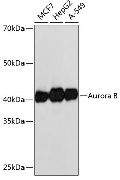 Aurora B Antibody in Western Blot (WB)