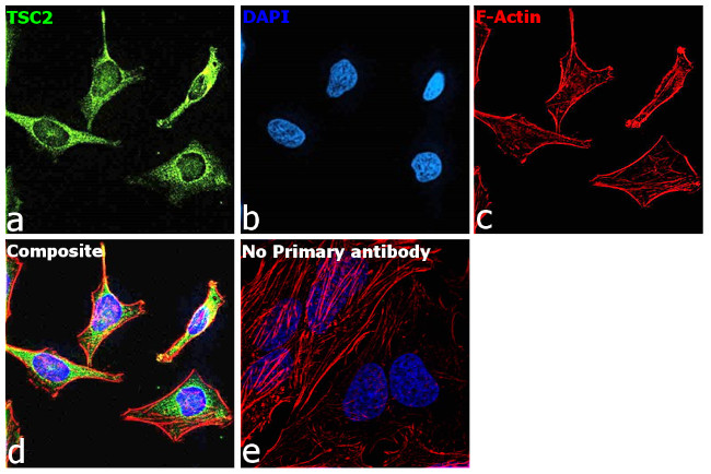 TSC2 Antibody in Immunocytochemistry (ICC/IF)