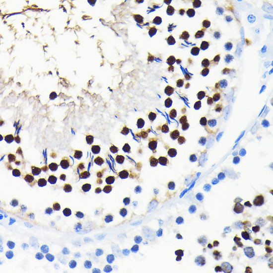 TCF7L2 Antibody in Immunohistochemistry (Paraffin) (IHC (P))