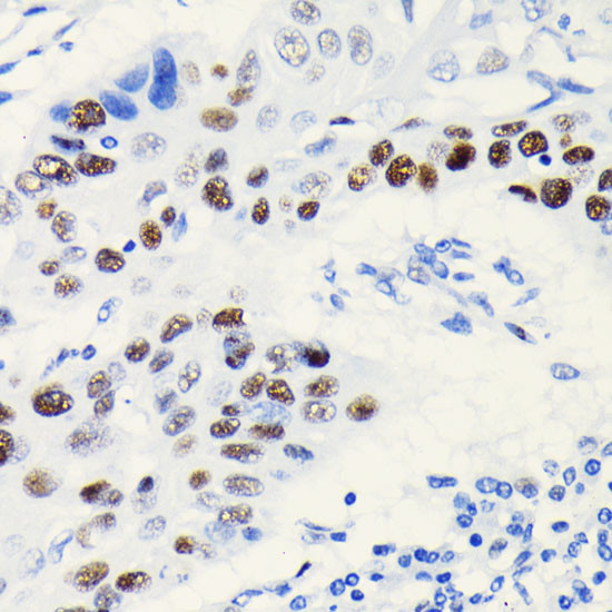 TCF7L2 Antibody in Immunohistochemistry (Paraffin) (IHC (P))