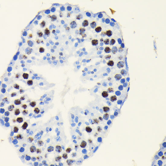 TCF7L2 Antibody in Immunohistochemistry (Paraffin) (IHC (P))