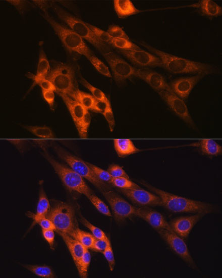 Caspase 6 Antibody in Immunocytochemistry (ICC/IF)