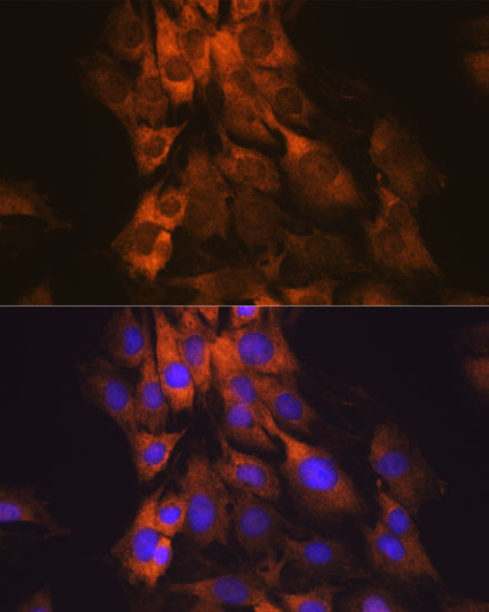 MEK1 Antibody in Immunocytochemistry (ICC/IF)