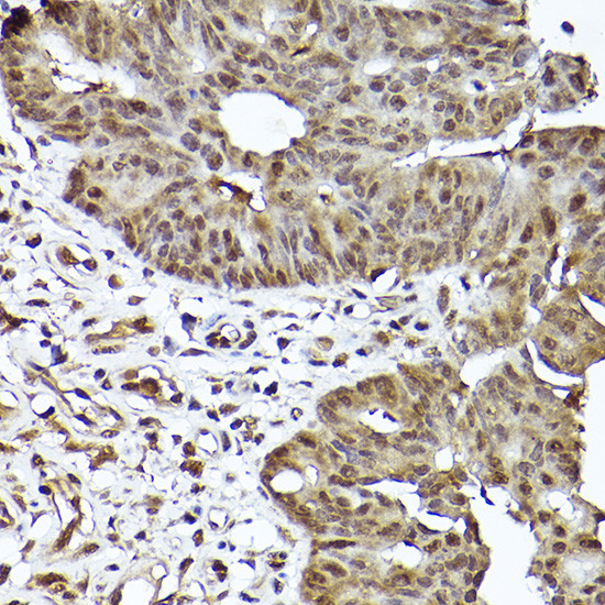 STAT3 Antibody in Immunohistochemistry (Paraffin) (IHC (P))