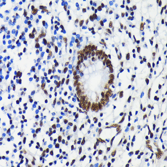 TRIM28 Antibody in Immunohistochemistry (Paraffin) (IHC (P))