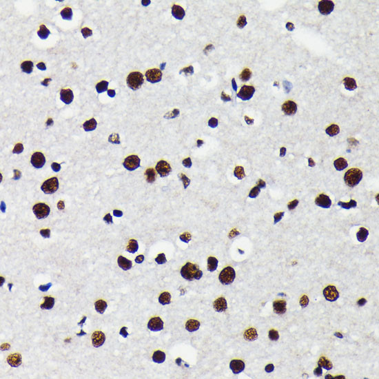 TRIM28 Antibody in Immunohistochemistry (Paraffin) (IHC (P))