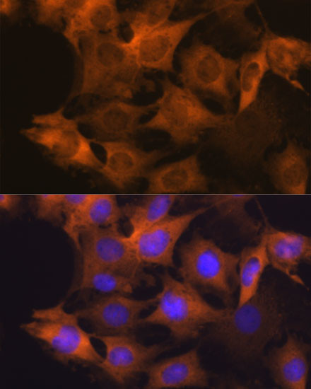 HSP90 beta Antibody in Immunocytochemistry (ICC/IF)