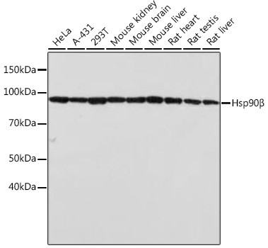 HSP90 beta Antibody in Western Blot (WB)