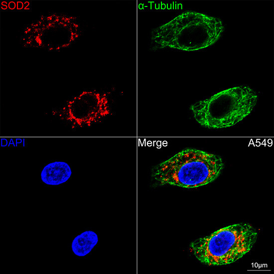 SOD2 Antibody in Immunocytochemistry (ICC/IF)