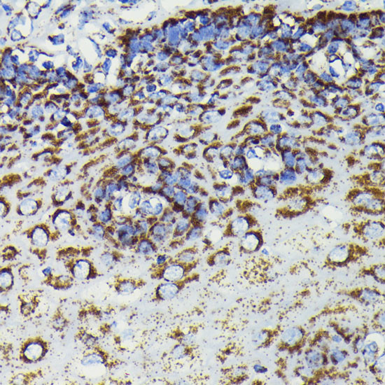 SOD2 Antibody in Immunohistochemistry (Paraffin) (IHC (P))