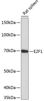 E2F1 Antibody in Western Blot (WB)