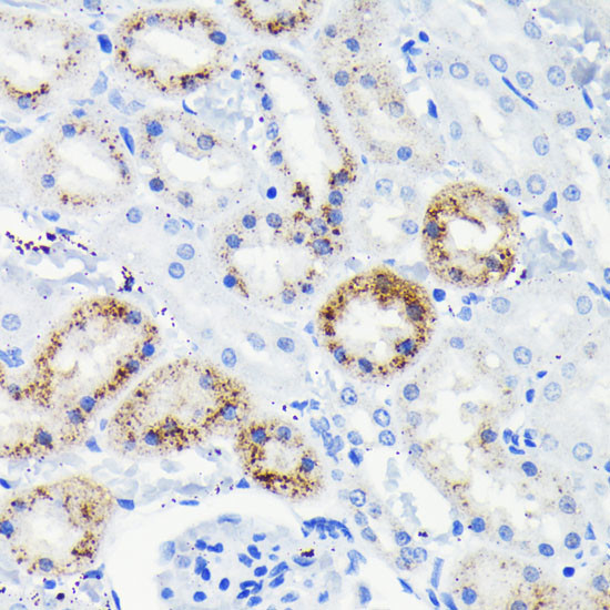 FAS Antibody in Immunohistochemistry (Paraffin) (IHC (P))