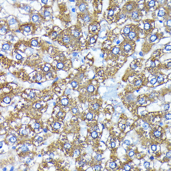 ATG3 Antibody in Immunohistochemistry (Paraffin) (IHC (P))