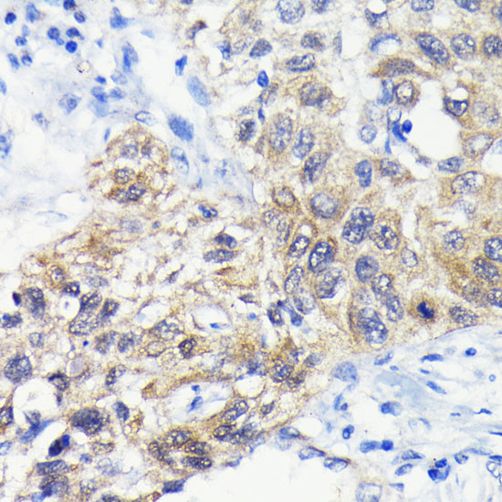 ATG3 Antibody in Immunohistochemistry (Paraffin) (IHC (P))