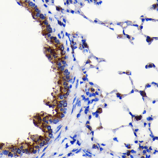 ATG3 Antibody in Immunohistochemistry (Paraffin) (IHC (P))