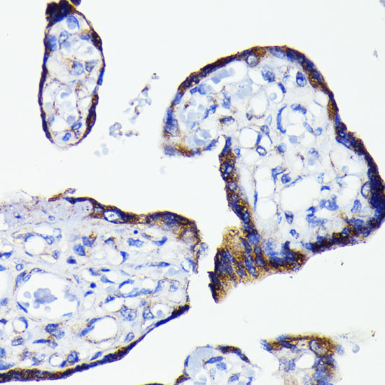 BAD Antibody in Immunohistochemistry (Paraffin) (IHC (P))