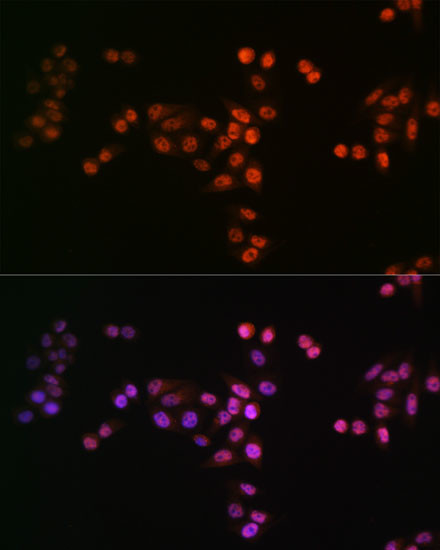 Drosha Antibody in Immunocytochemistry (ICC/IF)