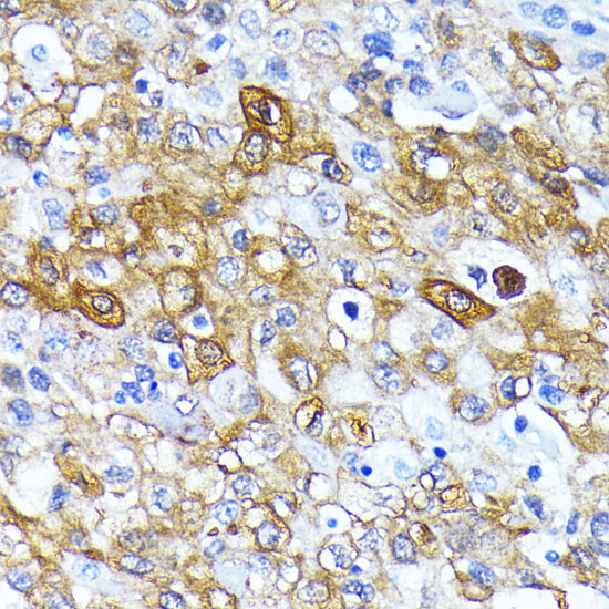 ATG7 Antibody in Immunohistochemistry (Paraffin) (IHC (P))