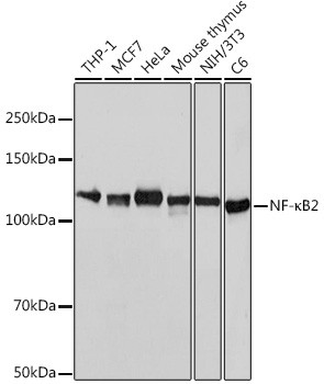 NFkB p52/p100 Antibody in Western Blot (WB)