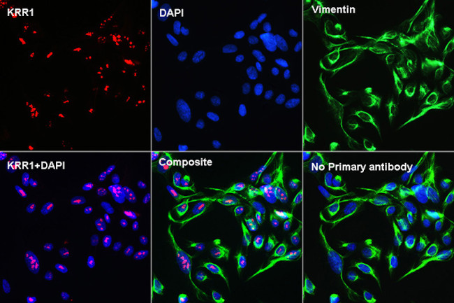 Vimentin Antibody in Immunocytochemistry (ICC/IF)