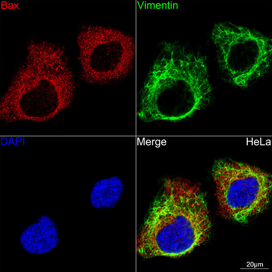 Vimentin Antibody in Immunocytochemistry (ICC/IF)