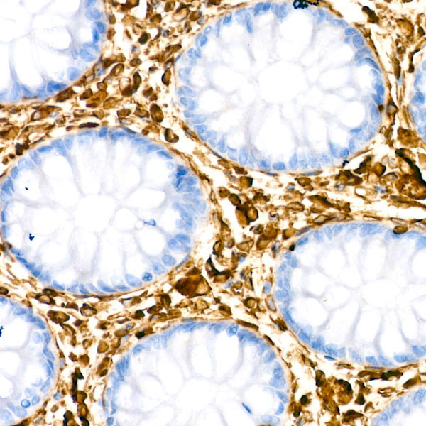 Vimentin Antibody in Immunohistochemistry (Paraffin) (IHC (P))