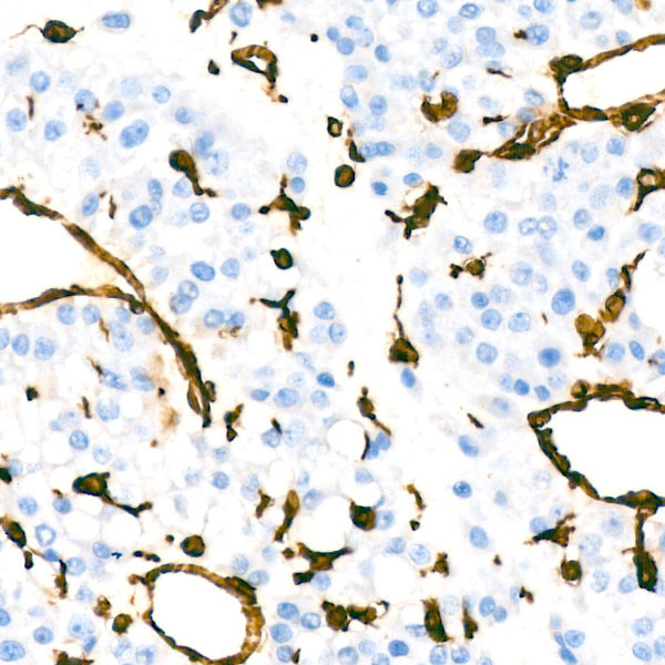 Vimentin Antibody in Immunohistochemistry (Paraffin) (IHC (P))