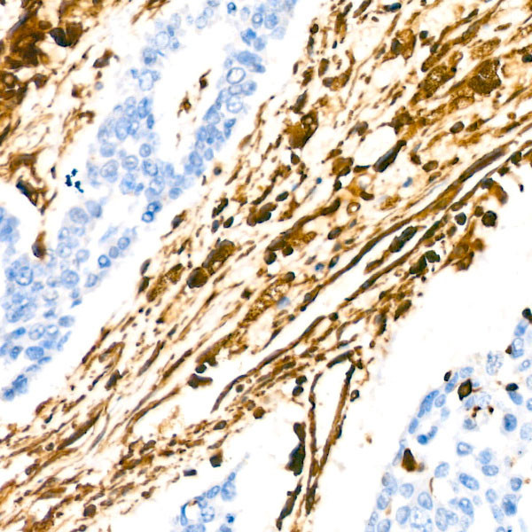 Vimentin Antibody in Immunohistochemistry (Paraffin) (IHC (P))