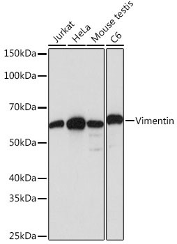 Vimentin Antibody in Western Blot (WB)