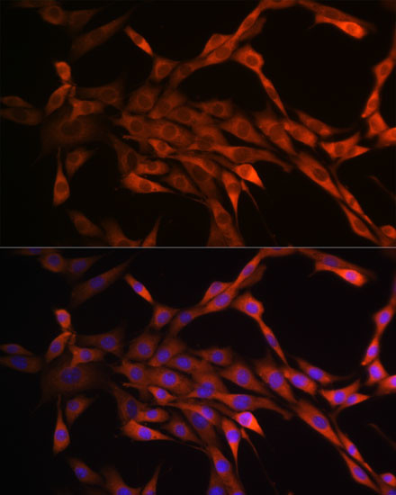 PAK1 Antibody in Immunocytochemistry (ICC/IF)