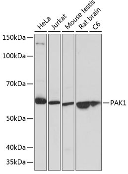 PAK1 Antibody in Western Blot (WB)
