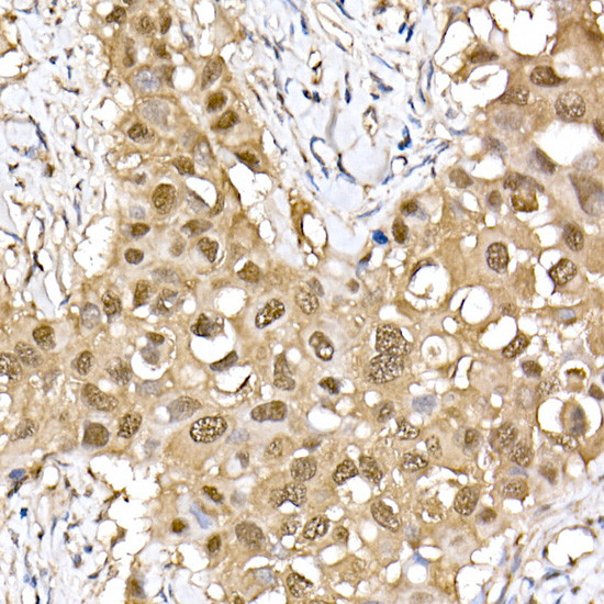 ERK2 Antibody in Immunohistochemistry (Paraffin) (IHC (P))