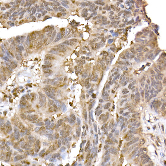 ERK2 Antibody in Immunohistochemistry (Paraffin) (IHC (P))