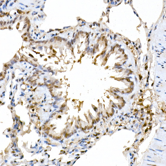 ERK2 Antibody in Immunohistochemistry (Paraffin) (IHC (P))