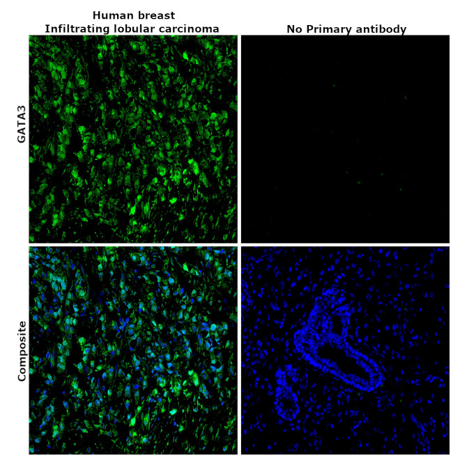 GATA3 Antibody in Immunohistochemistry (Paraffin) (IHC (P))