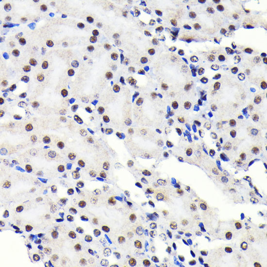 SP1 Antibody in Immunohistochemistry (Paraffin) (IHC (P))