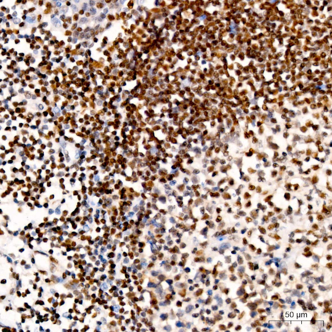 ATM Antibody in Immunohistochemistry (Paraffin) (IHC (P))