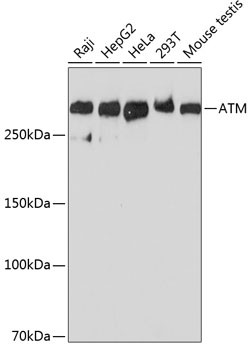 ATM Antibody in Western Blot (WB)