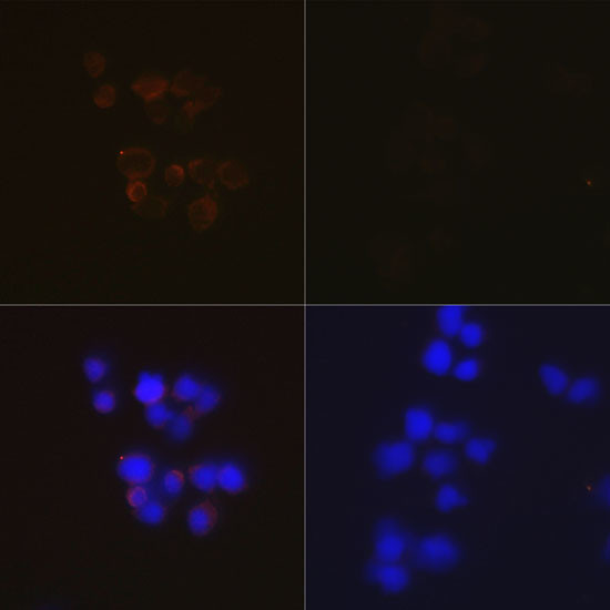 Caspase 3 p12 Antibody in Immunocytochemistry (ICC/IF)