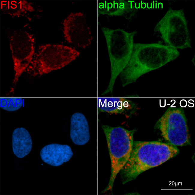 FIS1 Antibody in Immunocytochemistry (ICC/IF)