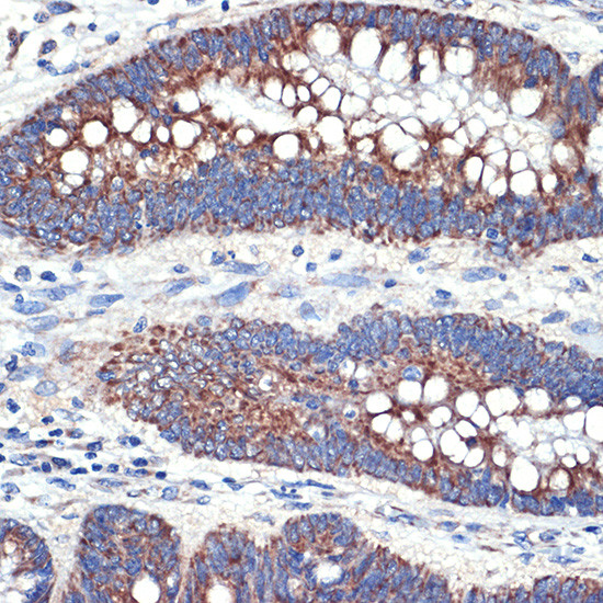 FIS1 Antibody in Immunohistochemistry (Paraffin) (IHC (P))