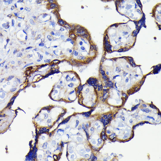 ATG5 Antibody in Immunohistochemistry (Paraffin) (IHC (P))